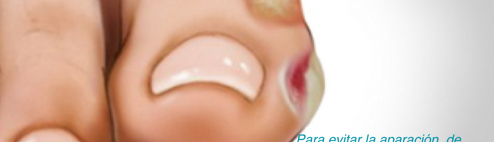 Como prevenir las ampollas en los pies